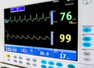 Badanie rytmu serca. Badanie Holter EKG Warszawa Mokotów w MediPark. EKG w Warszawie.